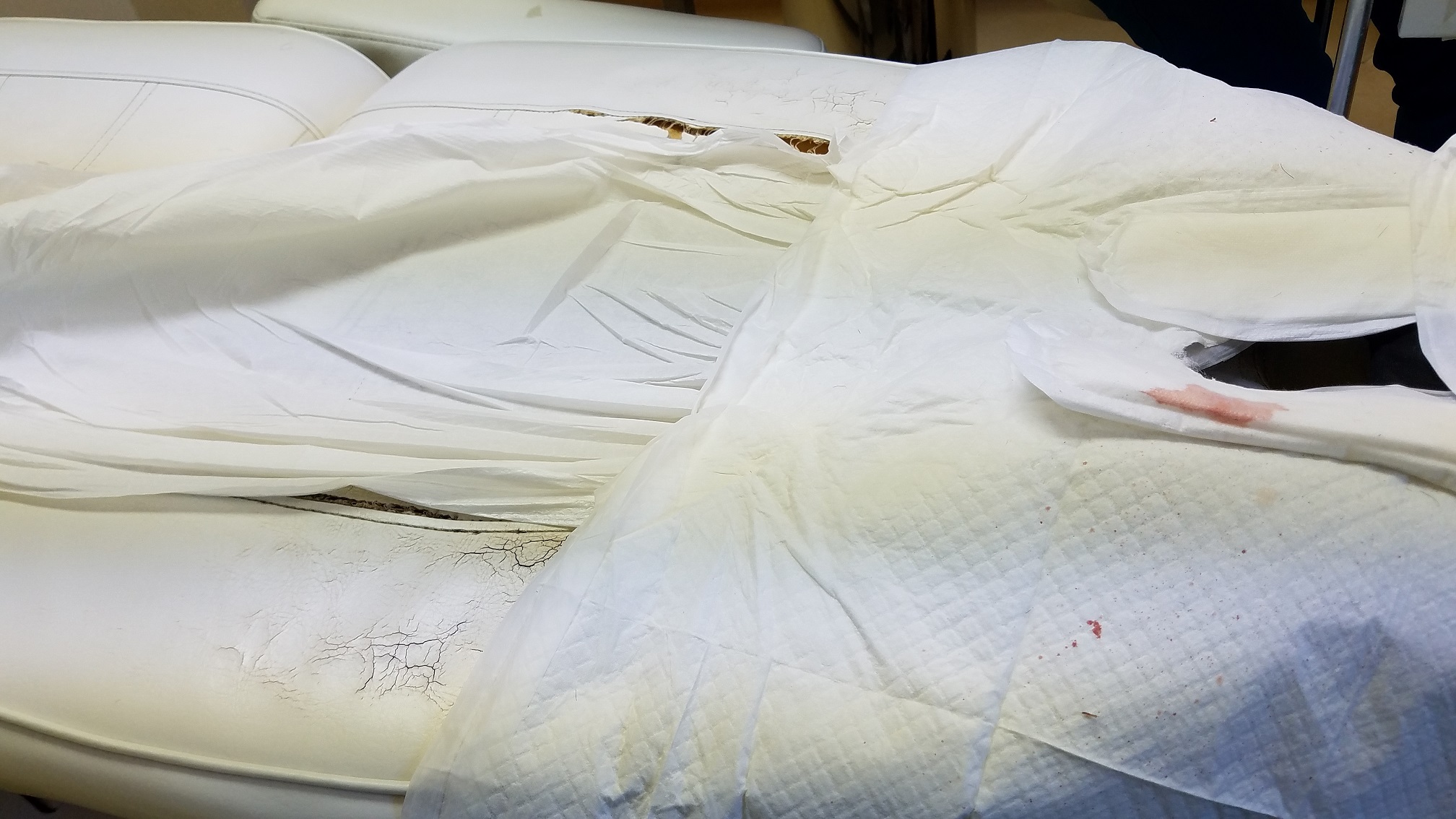 Loši uslovi u jednoj od klinika u Turskoj za presađivanje kose, krevet za proceduru