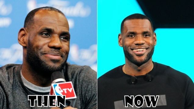 LeBron James also had a hair transplant (VIDEO)