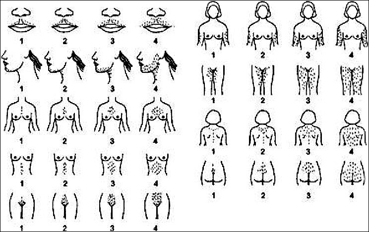 I žene imaju mušku maljavost